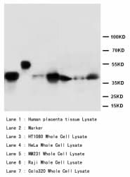MAPK3 / ERK1 Antibody (aa365-379)