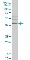 Monoclonal Mouse anti-Human HHEX / HEX Antibody (clone 3F11, WB)