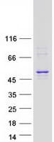 Human AURKA / Aurora-A Protein (Recombinant Myc-DDK (Flag))