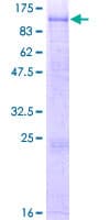 Human CPXM1 / CPXM Protein (Recombinant GST)