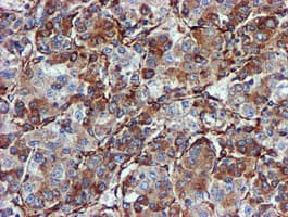 CYB5R3 / B5R Antibody (clone OTI1E8)