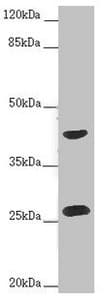 Polyclonal Rabbit anti-Human RAB12 Antibody (IF, WB)