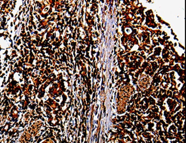 MMP13 Antibody