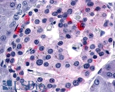 PathPlus™ Polyclonal Rabbit anti-Human GPR35 Antibody (Extracellular Domain, IHC)