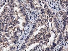 ACOT12 Antibody (clone OTI1A11)