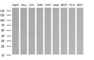 RNF39 Antibody (clone OTI5F5)
