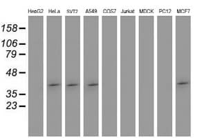 SETD7 / SET7 Antibody (clone OTI2E3, Carrier-free)