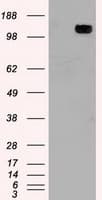 Monoclonal Mouse anti-Human TRPM4 Antibody (clone OTI3C4, WB)