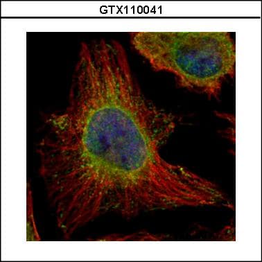 EPHX1 / Epoxide Hydrolase 1 Antibody (aa14-292)