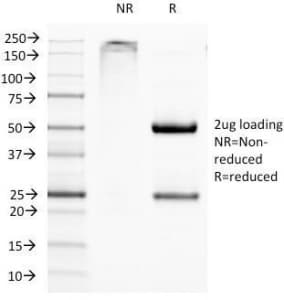 ITGAX / CD11c Antibody (clone ITGAX/1284)