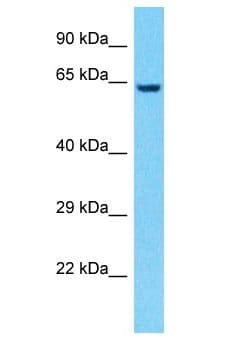 IMP-3 / IGF2BP3 Antibody (aa213-262)