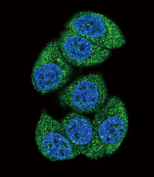 DCK / Deoxycytidine kinase Antibody (aa171-200)