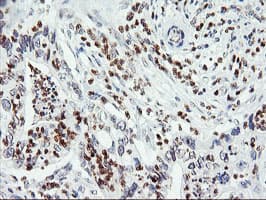 APMAP / C20orf3 Antibody (clone OTI1G8)