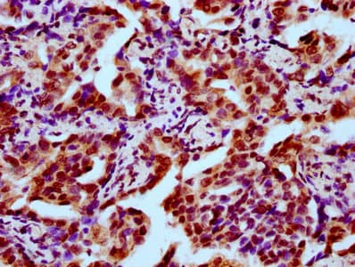 HIST1H2BN Antibody