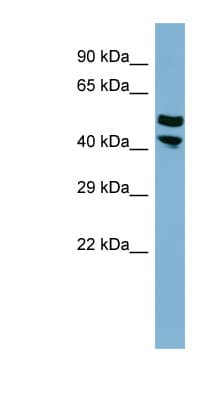 PRR5L / FLJ14213 Antibody (aa251-300)