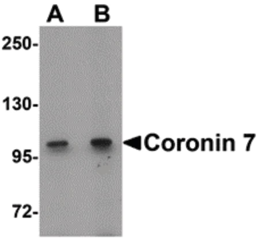 Polyclonal Rabbit anti-Human Coronin 7 / CORO7 Antibody (IHC, IF, WB)