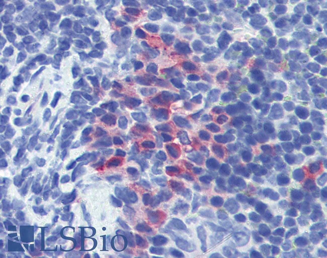 PathPlus™ ITGAM / CD11b Antibody (clone M1/70.15)