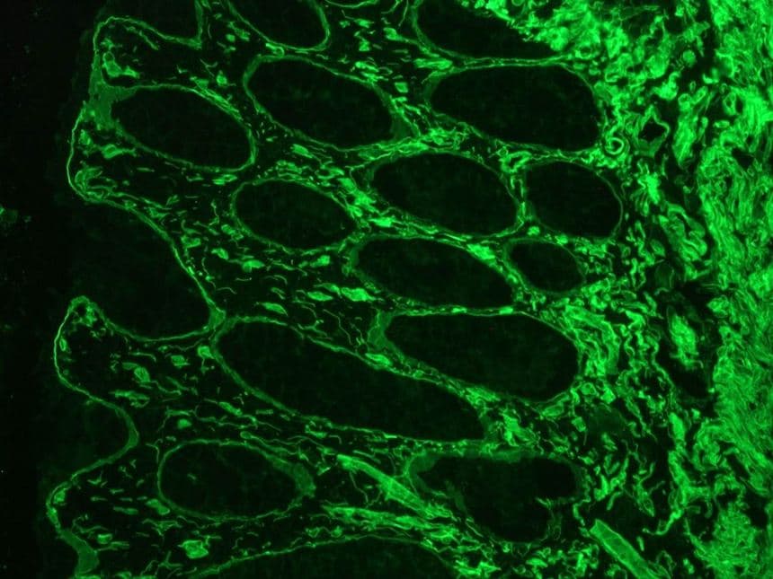 LAMC1 / Laminin Gamma 1 Antibody (clone A5)