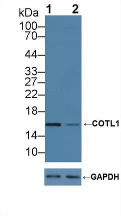 CLP / COTL1 Antibody (aa1-142)