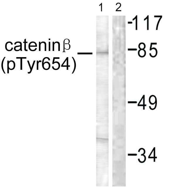 CTNNB1 / Beta Catenin Antibody (phospho-Tyr654)