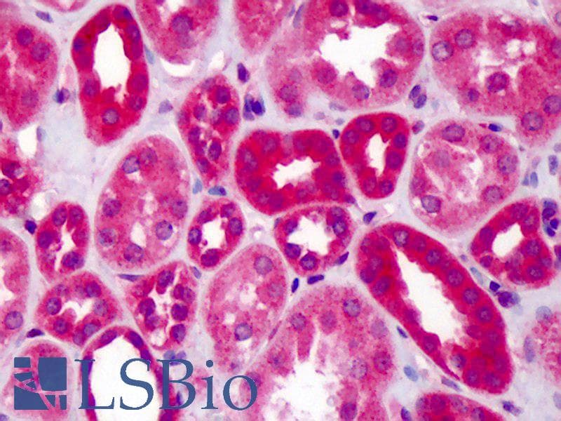 IHC-plus™ SLIT1 Antibody