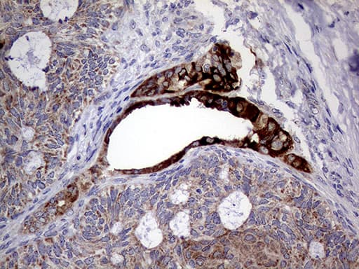 AGR2 Antibody (aa21-175, clone OTI2D11)