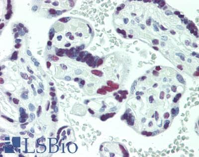 IHC-plus™ Polyclonal Rabbit anti-Human GMEB1 Antibody (aa523-573, IHC, WB)