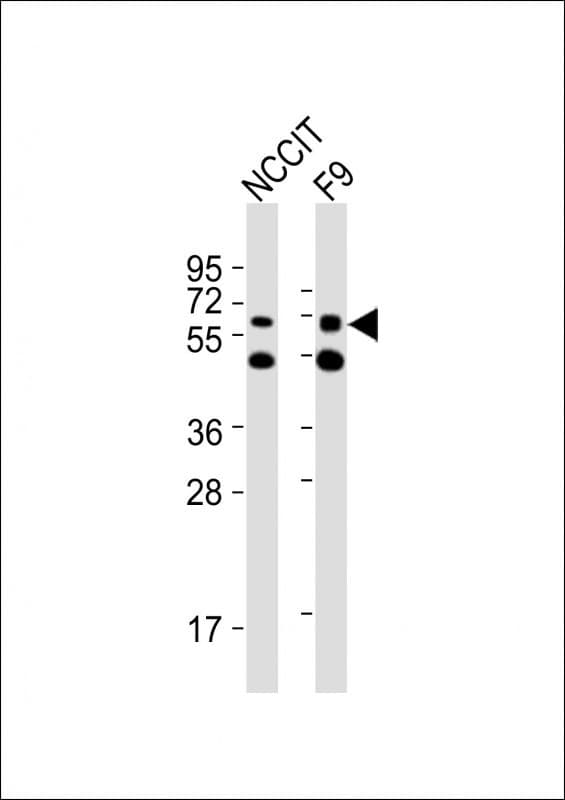 GNL3 / NS / Nucleostemin Antibody (aa420-454)