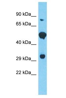 FAM166B Antibody (aa102-151)