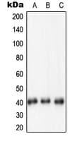 Polyclonal Rabbit anti-Human NPM1 / NPM / Nucleophosmin Antibody (N-Terminus, IHC, WB)