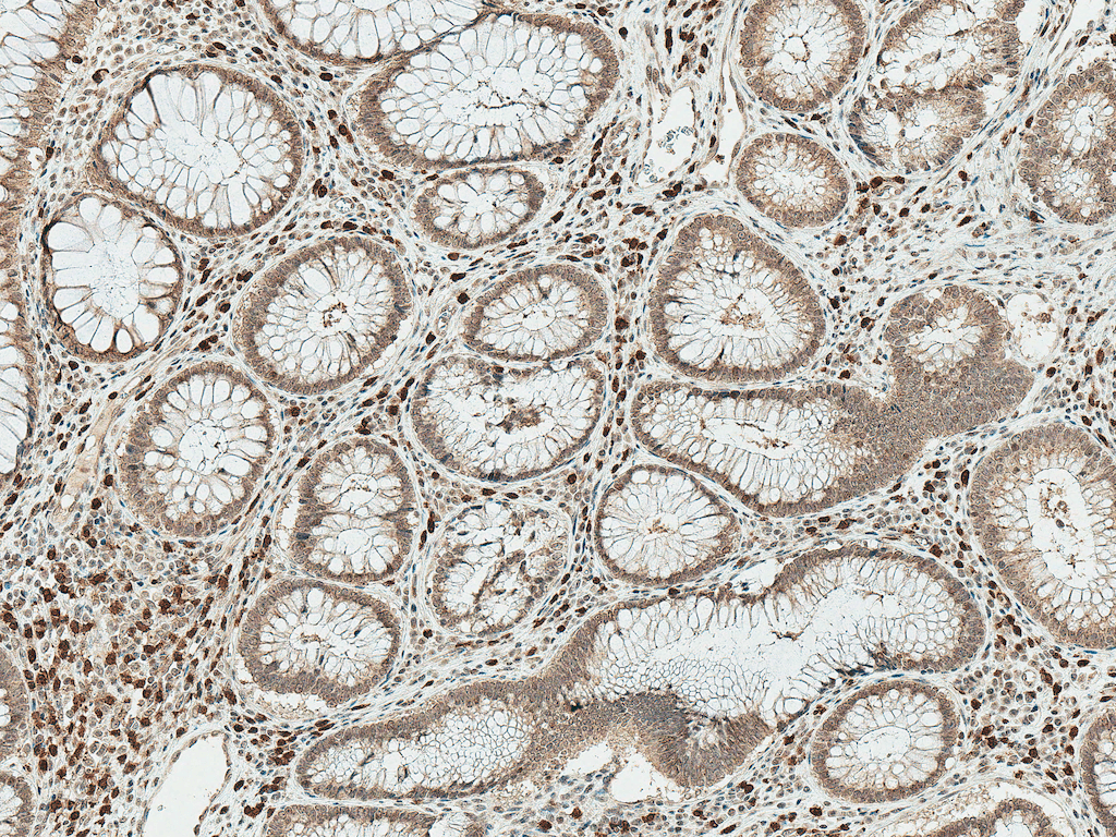 SMAD3 Antibody (FITC)