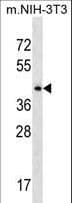 SEPT6 / Septin 6 Antibody (aa400-426)