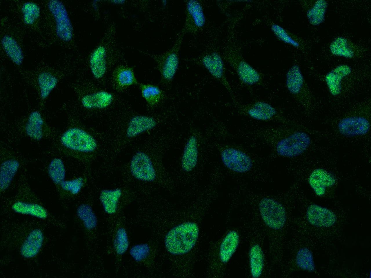 MAPK14 / p38 Antibody (clone 07, Preservative Free)