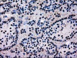 MRI1 Antibody (clone OTI9H7, Carrier-free)