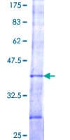 Human VPS52 / SACM2L Protein (Recombinant GST, N-terminus)