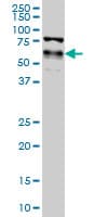 IHC-plus™ Monoclonal Mouse anti-Human YAP / YAP1 Antibody (clone 2F12, IHC, IF, WB)