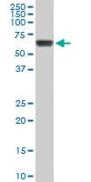 Monoclonal Mouse anti-Human RICK / RIP2 Antibody (clone 3D9, WB)