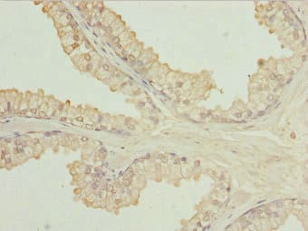 Polyclonal Rabbit anti-Human ULK3 Antibody (IHC)