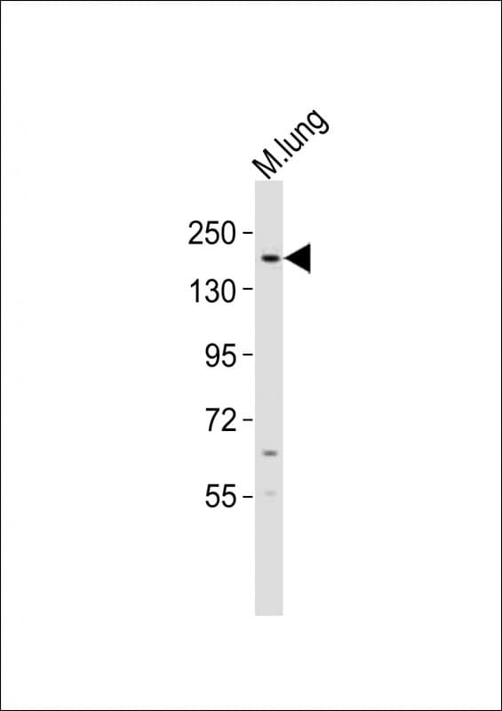KDM6B / JMJD3 Antibody (aa879-912)