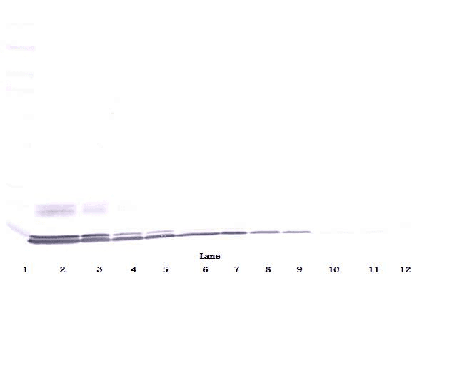 CCL2 / MCP1 Antibody