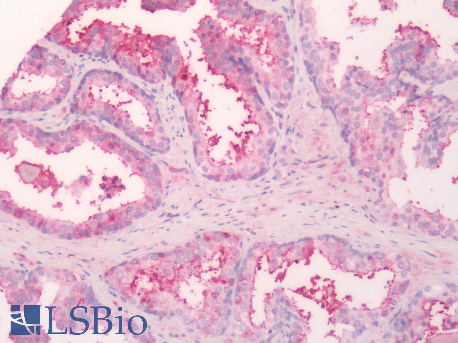 IHC-plus™ SLC5A3 Antibody (Internal)