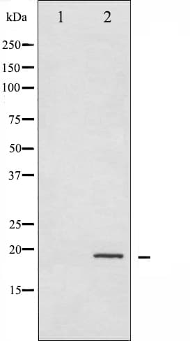 CFL1 / Cofilin Antibody (phospho-Ser3)