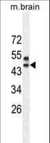 SPRED3 Antibody (aa31-59)