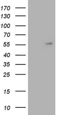 ANGPT1 / Angiopoietin-1 Antibody (aa20-320, clone OTI8C5)