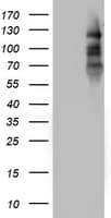 PR / Progesterone Receptor Antibody (aa1-298, clone OTI4B3)