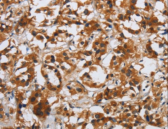 Polyclonal Rabbit anti-Human DSP / Desmoplakin Antibody (IHC)