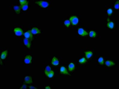 Polyclonal Rabbit anti-Human SIPR2 / S1P2 / EDG5 Antibody (IHC, WB)