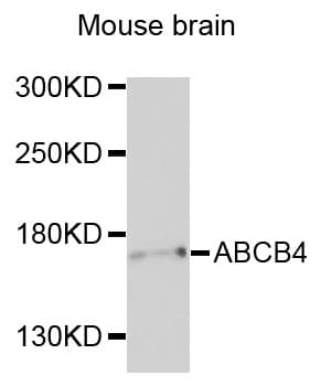 IHC-plus™ ABCB4 / MDR3 Antibody