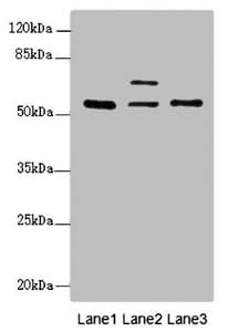 Polyclonal Rabbit anti-Human ERO1A / ERO1L Antibody (IHC, WB)