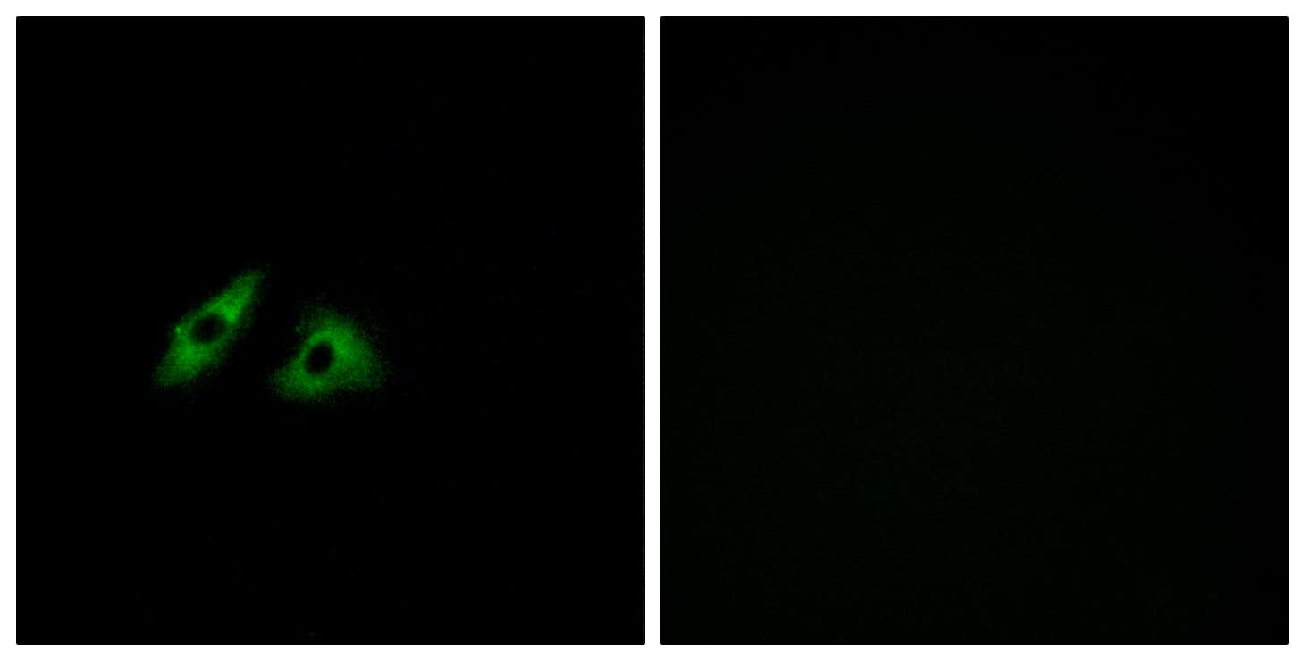 GPR152 Antibody (aa301-350)